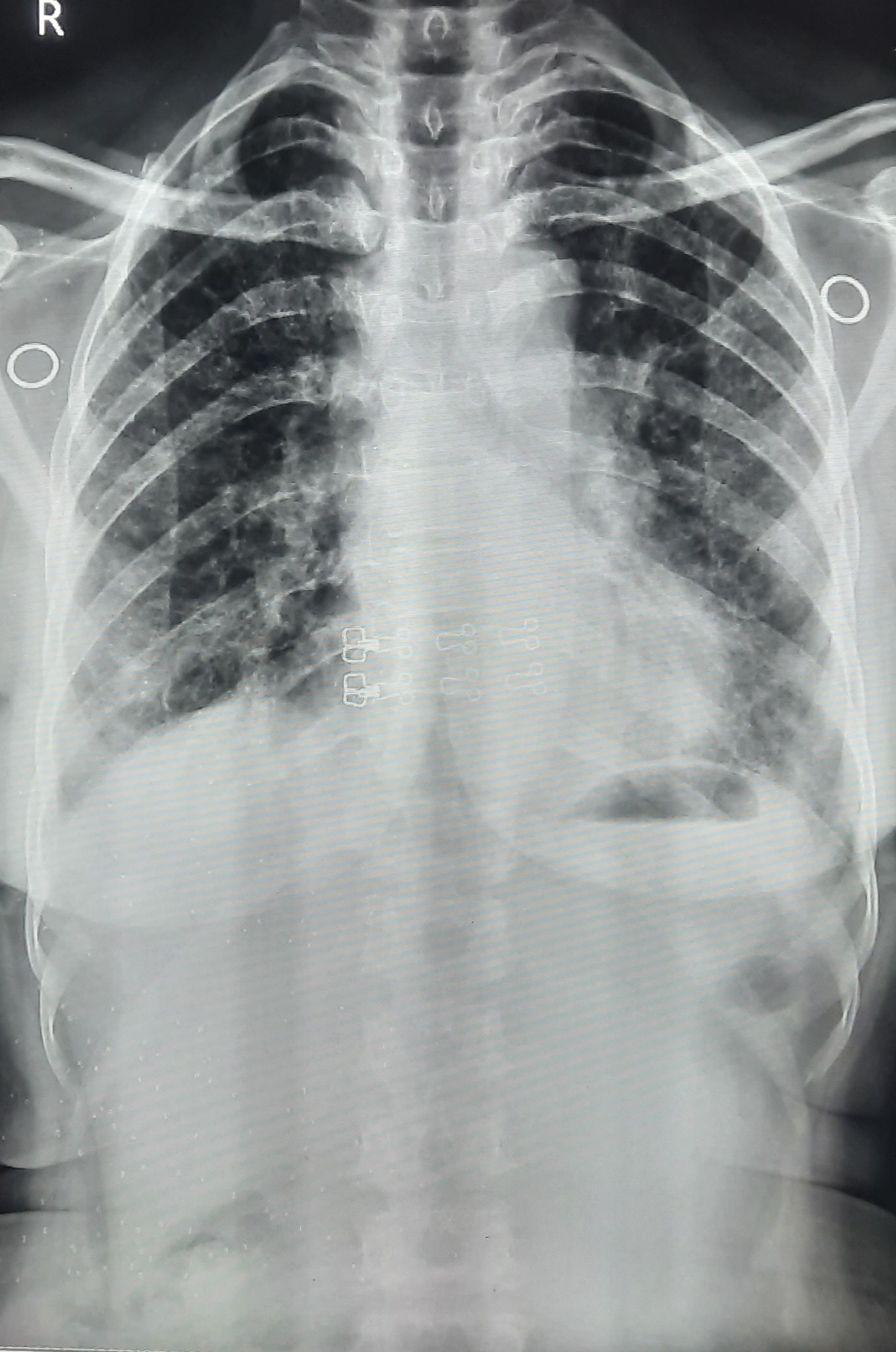 Patient Detail
