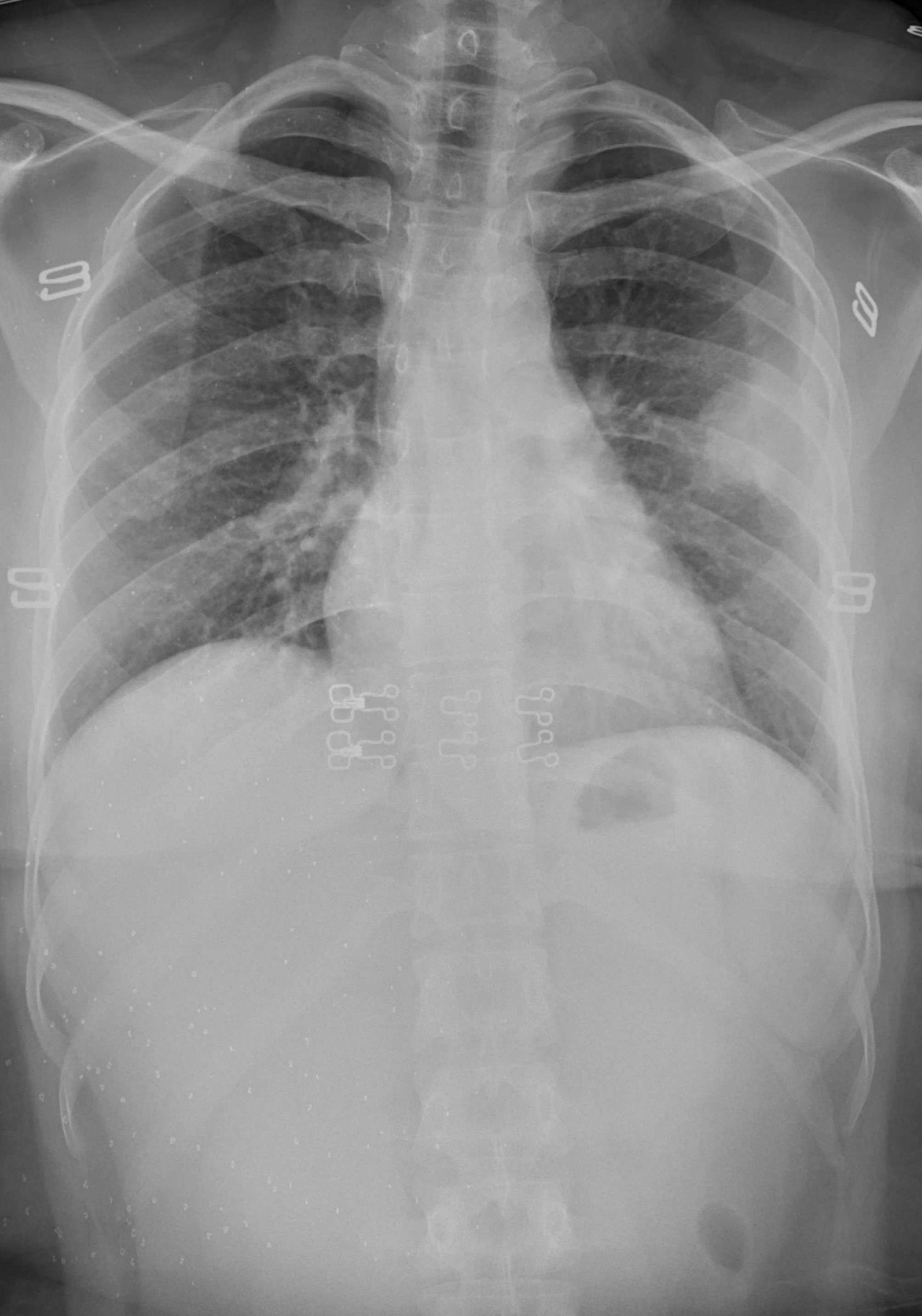 Patient Detail