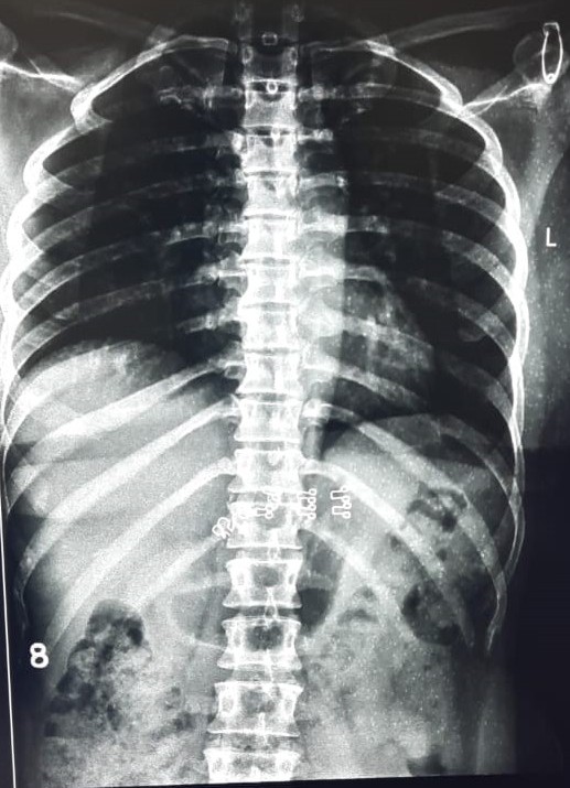 Normal Rug X Ray Patient Detail
